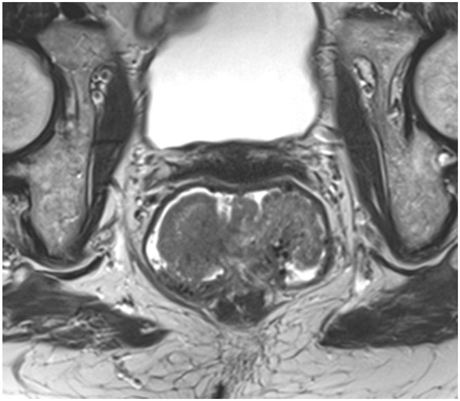 FIGURE 11: