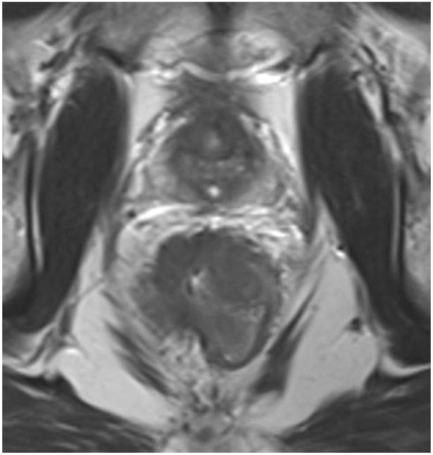 Figure 21: