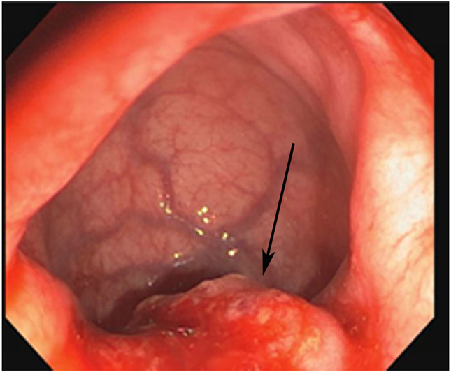 FIGURE 11: