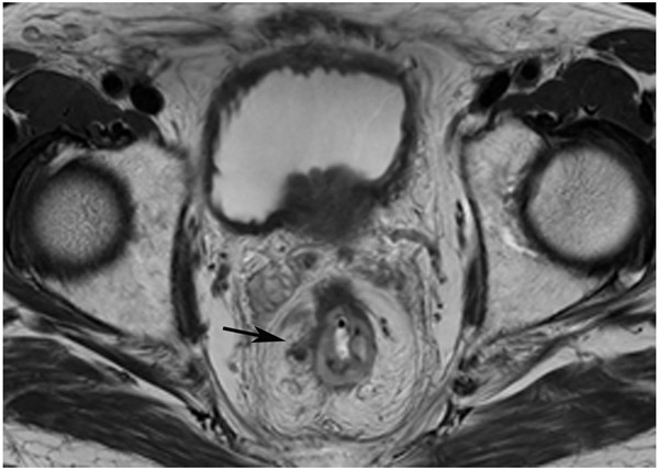 Figure 25: