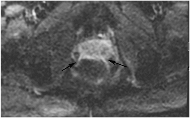 Figure 22: