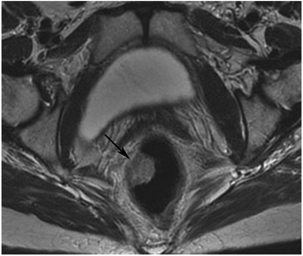 Figure 15: