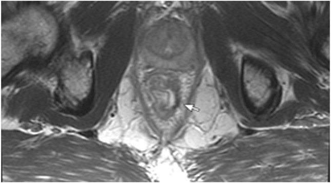 Figure 23: