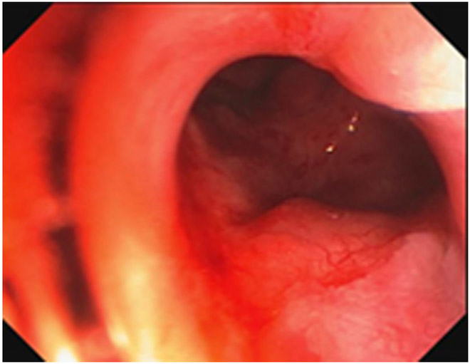 Figure 24: