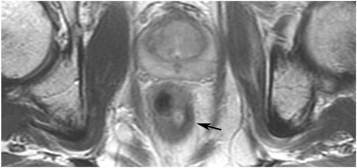 Figure 23: