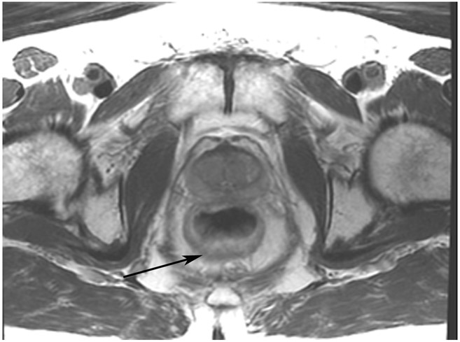 Figure 22: