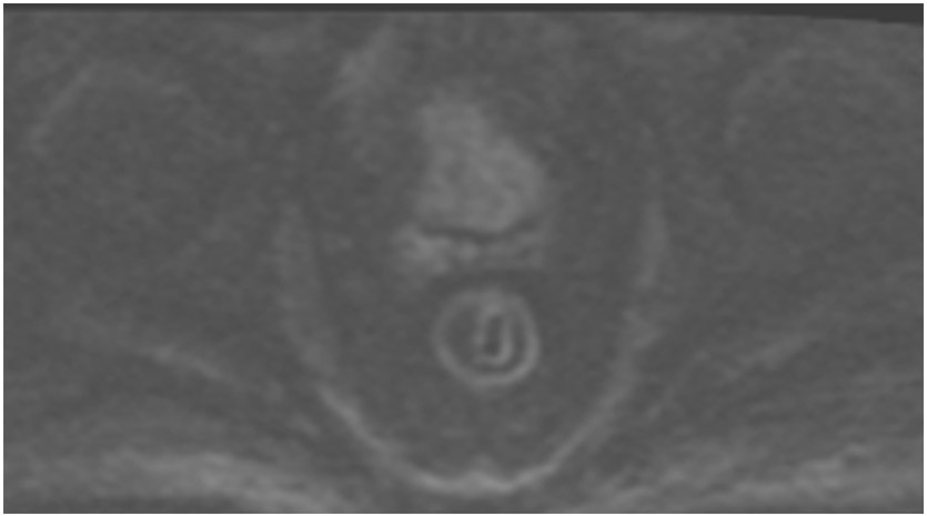 Figure 25: