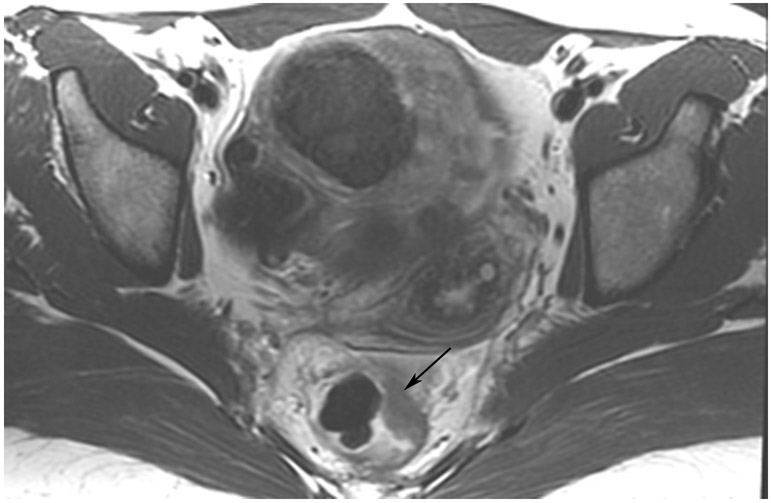 FIGURE 13: