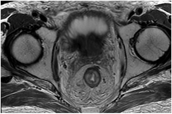 Figure 25: