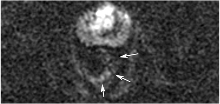 Figure 23: