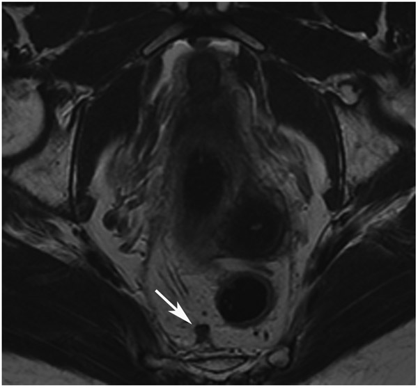 Figure 26: