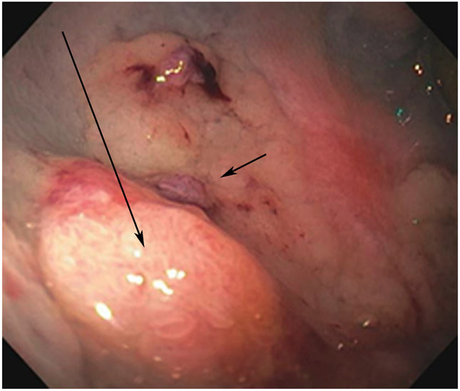 FIGURE 13: