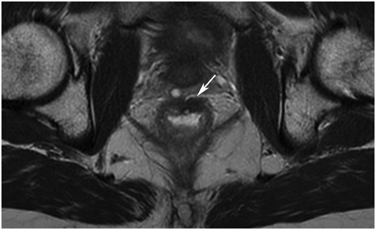 Figure 19: