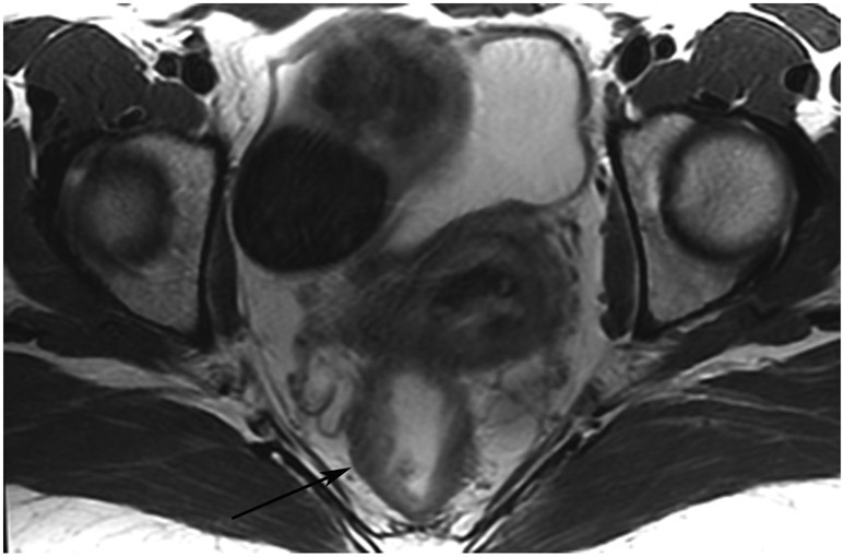 FIGURE 13: