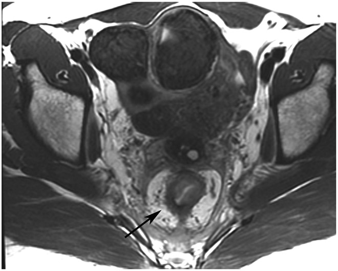 FIGURE 13: