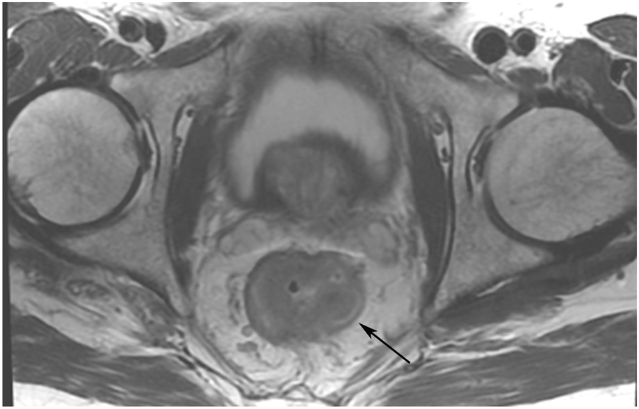 FIGURE 12: