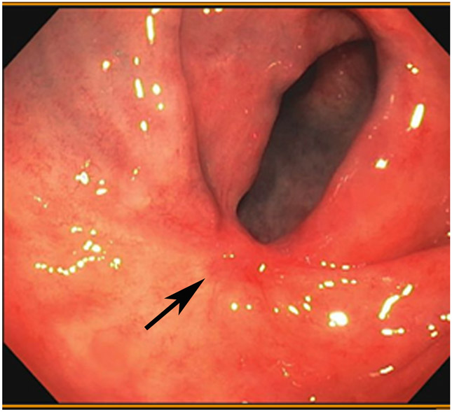 FIGURE 13: