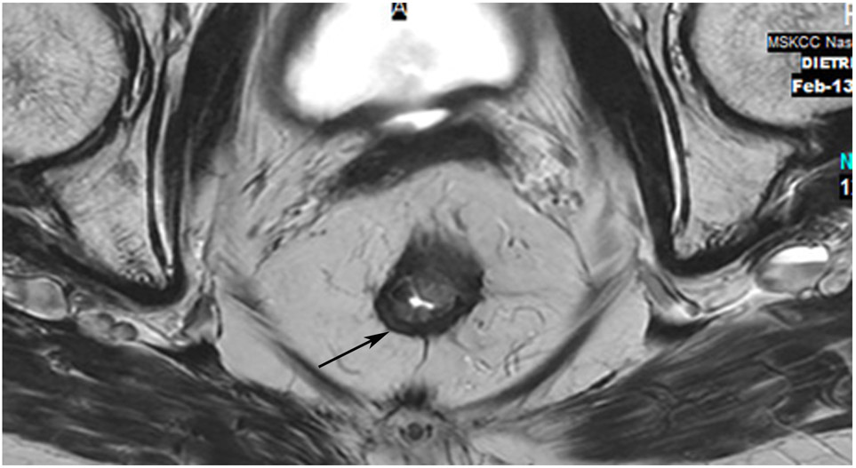 Figure 14: