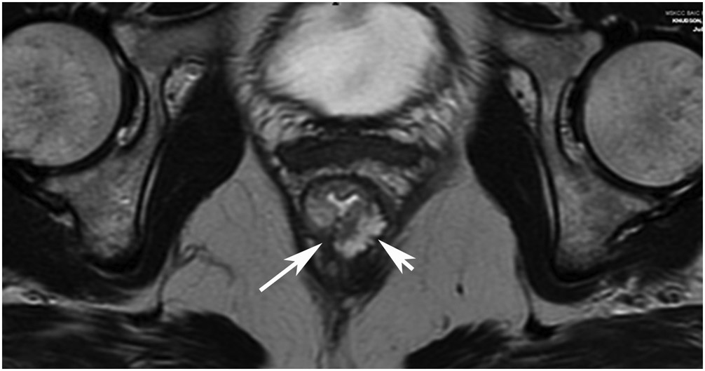 Figure 28: