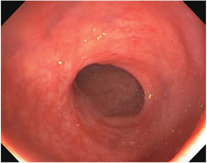 Figure 16: