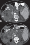 Figure 7 (a,b)