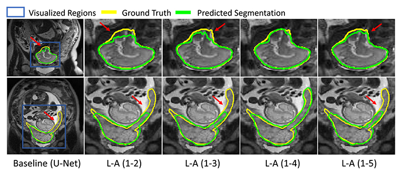 Fig. 11