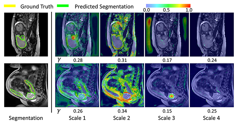 Fig. 12