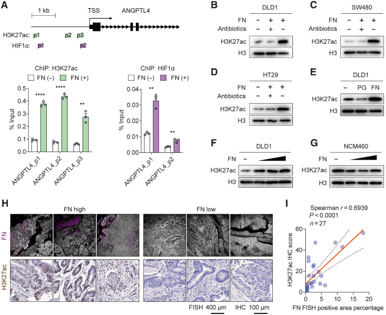 Figure 5. F. nucleatum colonization enhances the binding of HIF1α with ANGPTL4 and the level of acetylation of H3K27ac. A, ChIP-qPCR analysis of the level of H3K27ac and HIF1α binding within the promoter region of ANGPTL4, in DLD1 cultured with or without F. nucleatum (FN). Nonspecific DNA immunoprecipitation in isotype IgG control was not detectable (qPCR CT value >45) in all samples. Top, peak regions of H2K27ac and HIF1α binding within ANGPTL4 locus determined with ChIP-seq datasets in Cistrome Data Browser (n = 3 samples). TSS, transcription start site. B–G, Overall H3K27ac level determined by Western blot in different cell lines with indicated treatment. Gentamicin (300 μg/mL) and metronidazole (200 μg/mL) were added into the cocultures at the same time of F. nucleatum inoculation when antibiotics treatment was indicated in B and C. F. nucleatum or P. gingivalis (PG) was inoculated at an MOI of 5:1 in B–E and at an MOI of 5:1, 10:1, or 20:1 in F and G as indicated. H, Representative images of FISH-stained F. nucleatum (purple) and IHC-stained H3K27ac (brown) in paraffin-embedded colon adenocarcinoma tissues (n = 27). Human cell nuclei were stained with DAPI (gray) in FISH images and with hematoxylin (blue) in IHC images. I, Spearman correlation between the H3K27ac IHC score and the percentage of FISH-positive F. nucleatum area in paraffin-embedded colon adenocarcinoma tissues (n = 27). The orange line represents the best-fit linear regression, and the dotted line represents the 95% confidence intervals. The data in A are presented as mean ± SEM. Each circle represents an individual sample in A and I. Samples were collected from three independent experiments in A. For Western blots in B–G, two independent experiments were performed with similar results (**, P < 0.01; ****, P < 0.0001 by Wilcoxon rank-sum test).