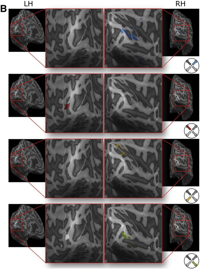 Fig. 10