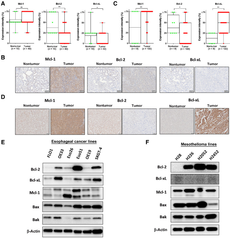 Figure 1. Expression levels of Bcl-2 protein family members in patient tissue and EAC and MPM cell lines. A, EAC samples were categorized into four levels of expression patterns, 10 normal esophageal tissues were compared with 40 tumor samples. B, Representative samples from IHC analysis of EAC samples microarray showing examples of expression of Bcl-2, Bcl-xL, and Mcl-1 (scale bar  = 50 μmol/L). C, MPM samples were categorized into four levels of expression patterns; eight normal tissues were compared with 100 tumor samples. D, Representative samples from IHC analysis of MPM samples microarray showing examples of expression of Bcl-2, Bcl-xL, and Mcl-1. E, Immunoblot of Bcl-2 family expression in EAC lines. F, Immunoblot of Bcl-2 family expression in MPM cell lines.