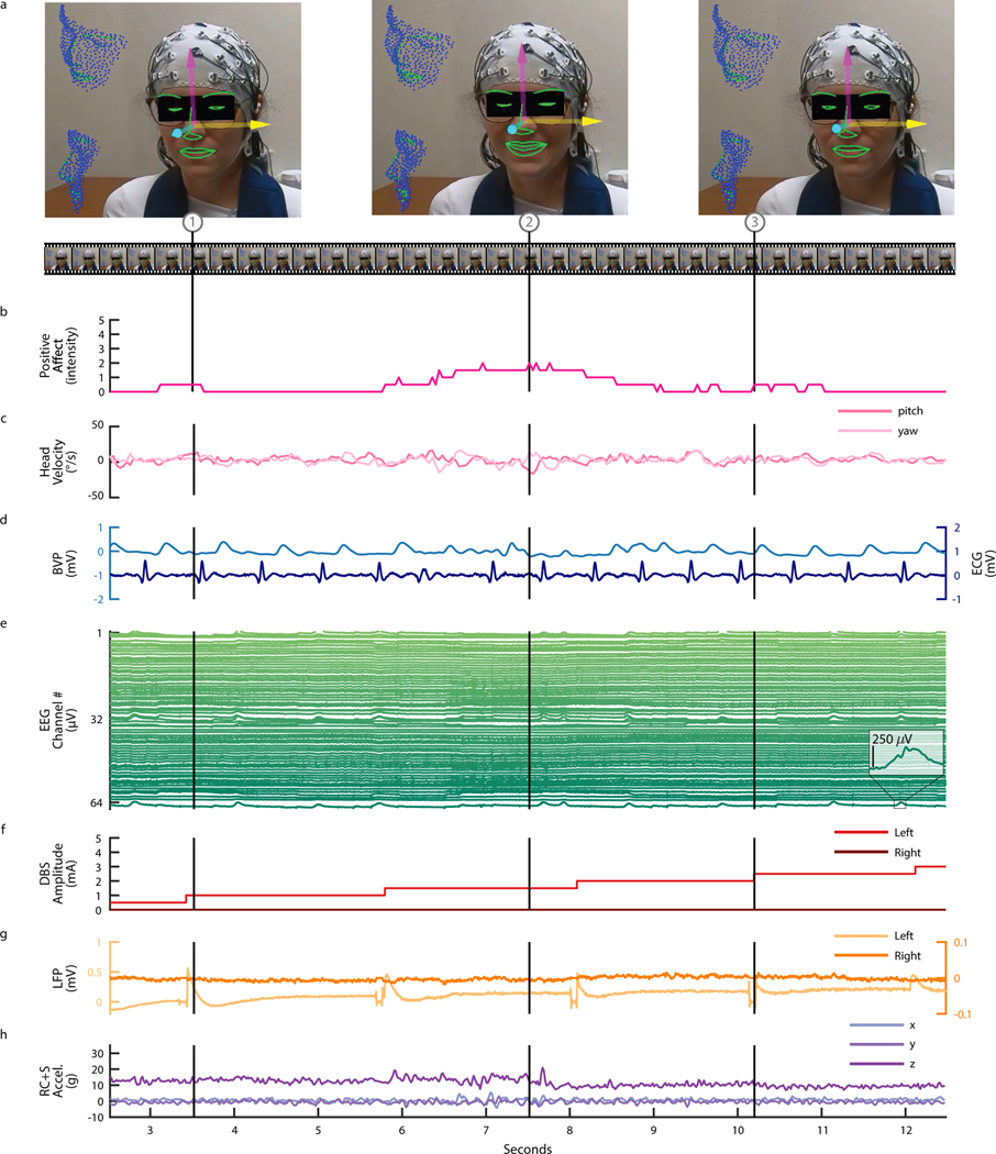 Figure 3: