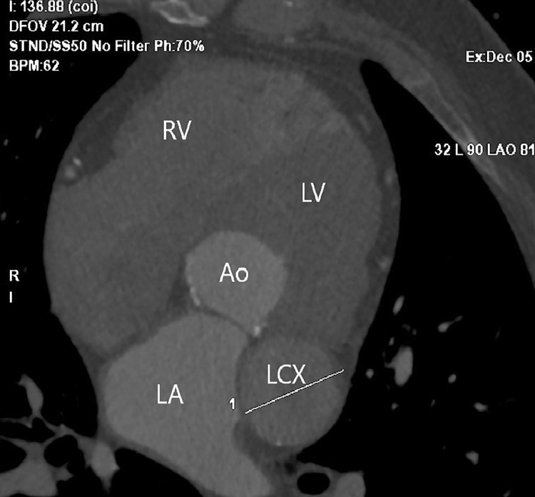 Fig 1 –