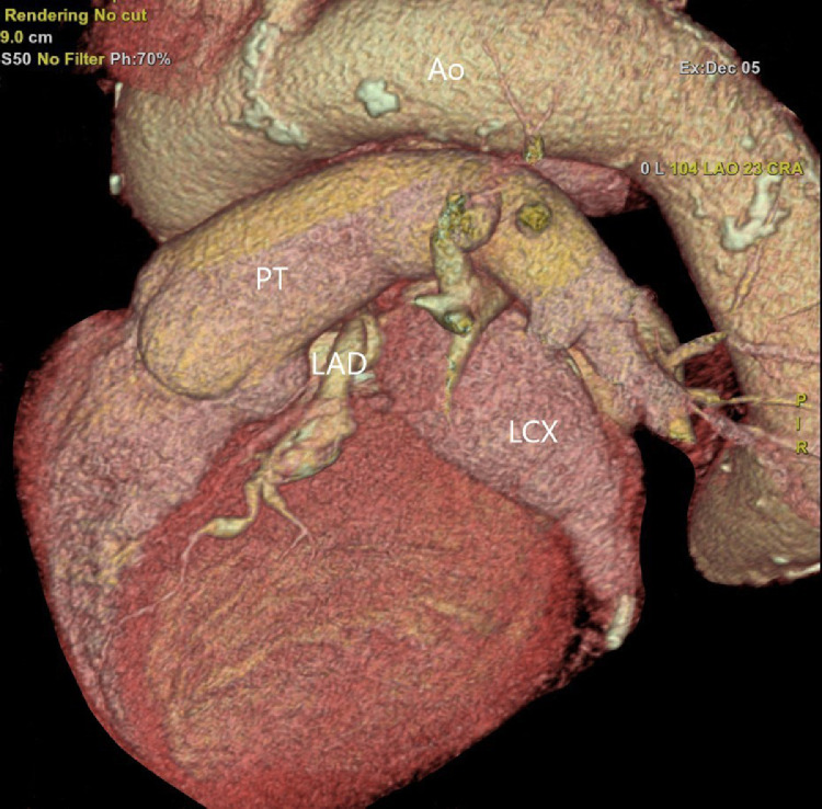 Fig 3 –