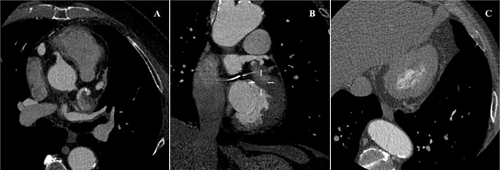 Fig 2 –