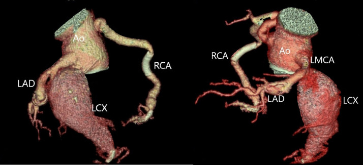 Fig 4 –