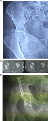 Fig. 6
