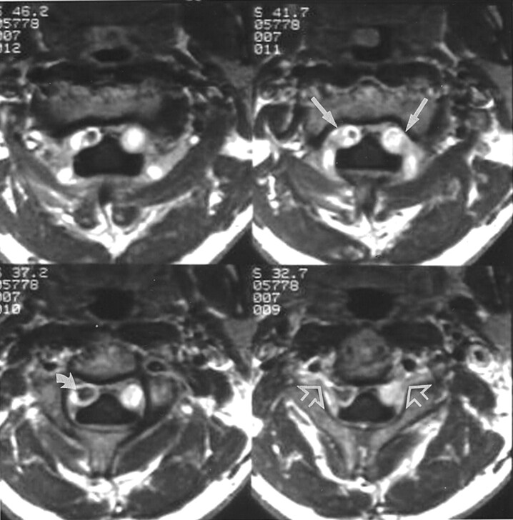 Fig 2.