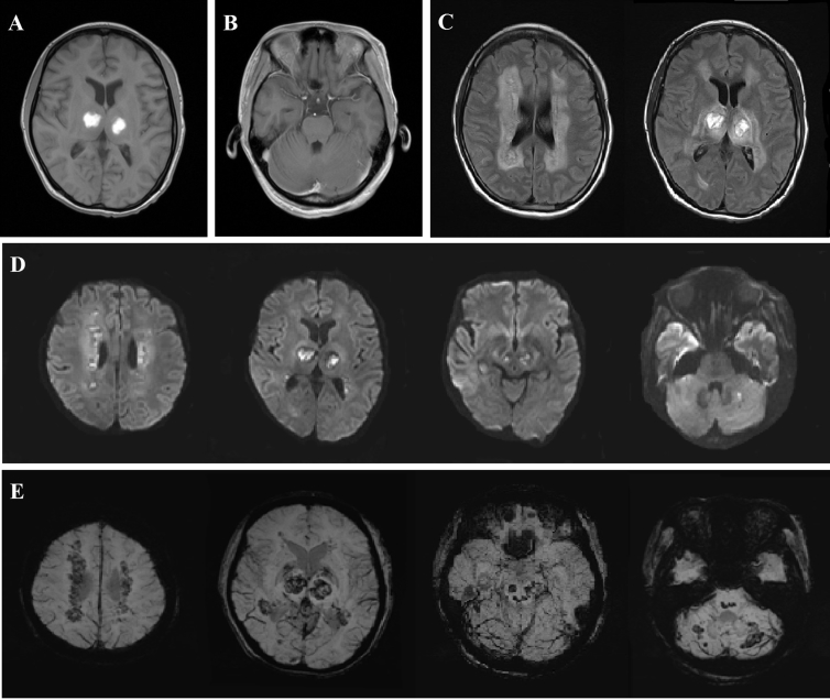 Fig. 2