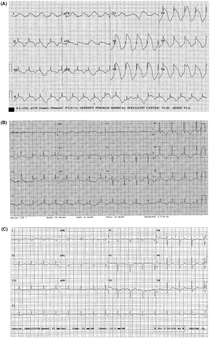 FIGURE 1