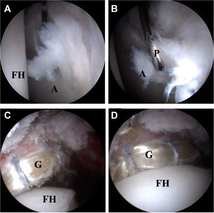 Fig 4