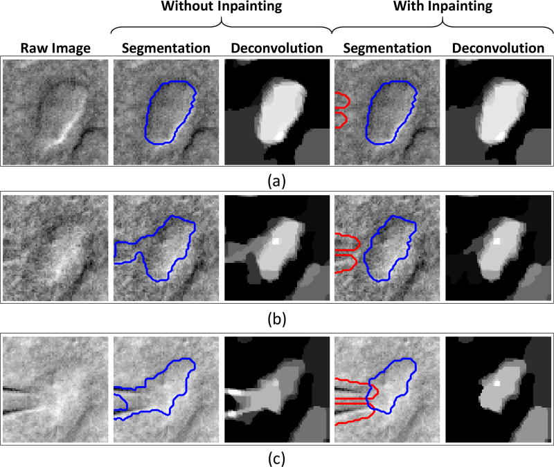 Fig. 14