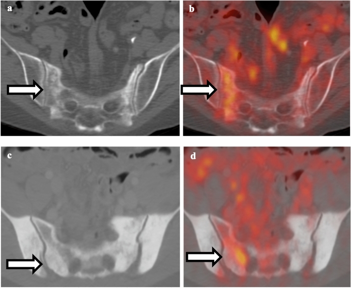 Fig. 11