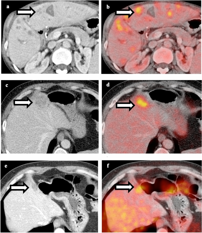 Fig. 7