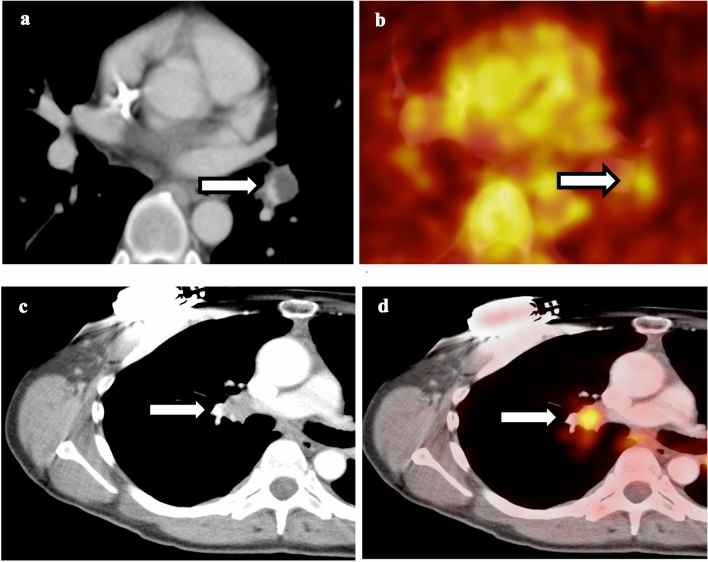 Fig. 3