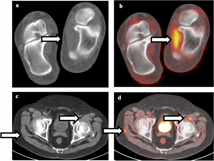 Fig. 9