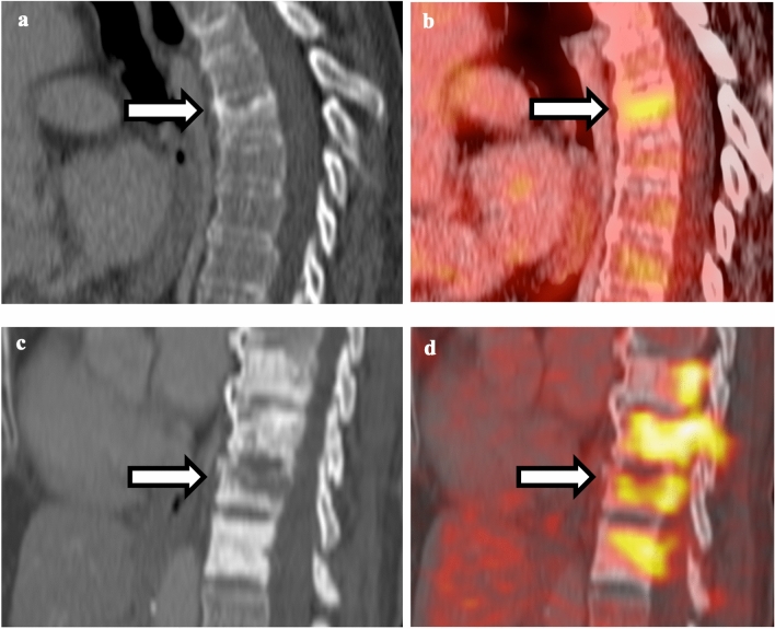 Fig. 10