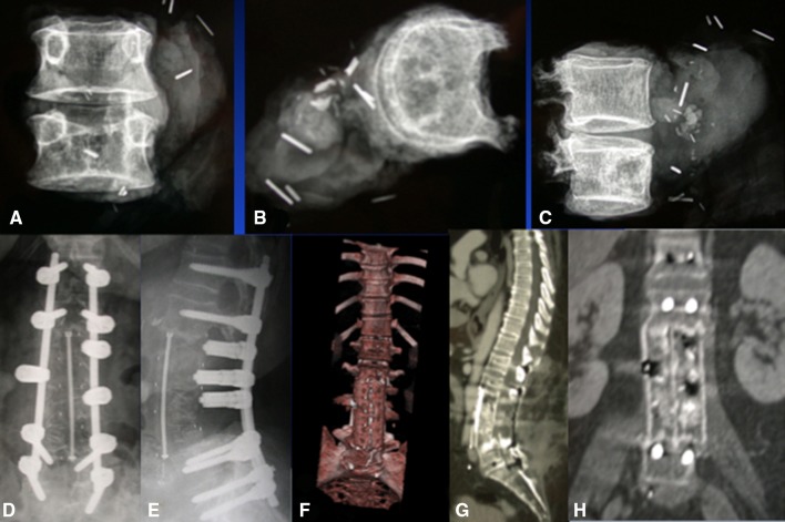 Fig. 2A–H