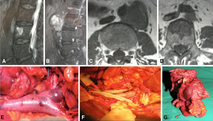 Fig. 1A–G