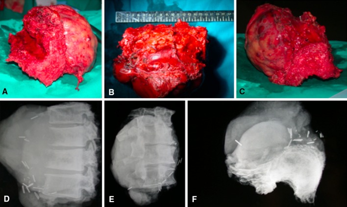 Fig. 4A–F