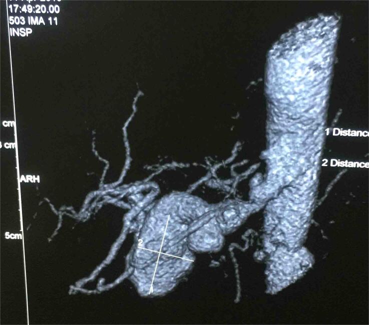 Figure 1 